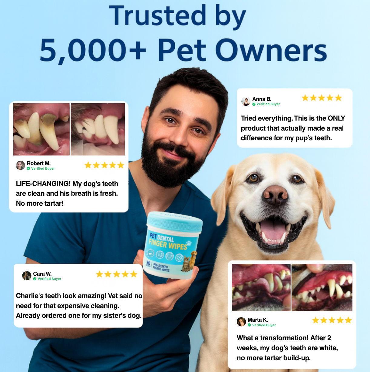 Pet Finger Dental Wipes
